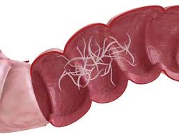 parassiti intestinali prima parte