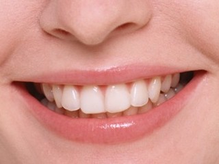 Denti : cura e benessere