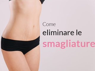 Come eliminare le smagliature: tutto quello che non sai