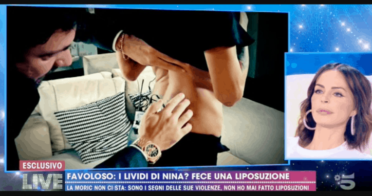 Nina Moric e le foto della violenza contestate